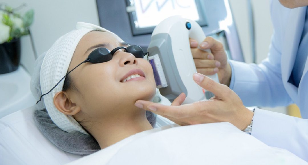 Fractional-CO2-Laser-Treatment